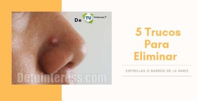 espinillas asquerosas