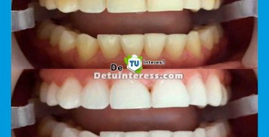 blanquear dientes de forma natural